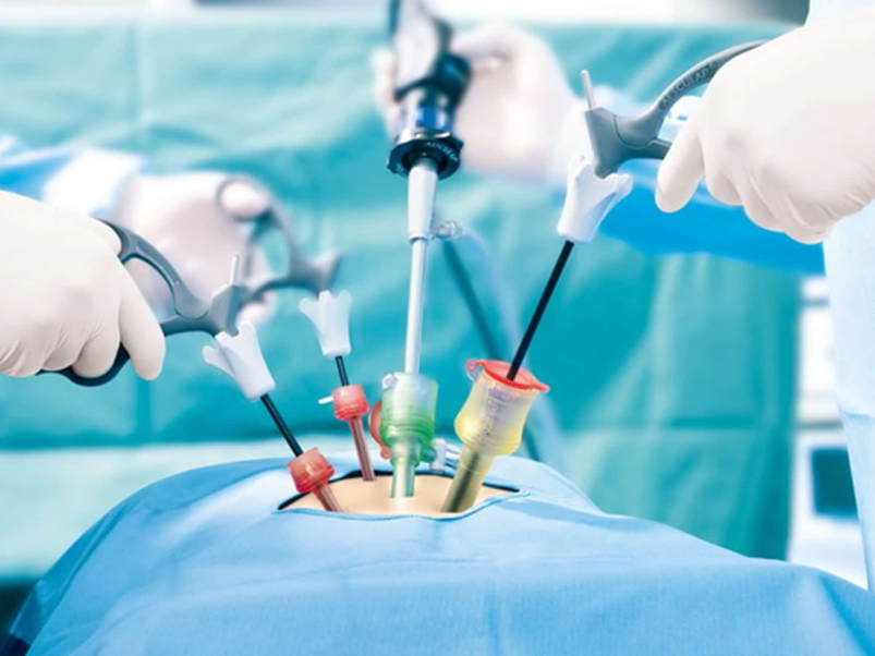 Laparoscopic Gynecology — Healia Women’s Health, Dubai