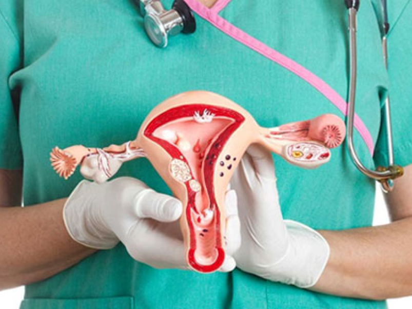 Laparoscopic Hysterectomy — Healia Women’s Health, Dubai
